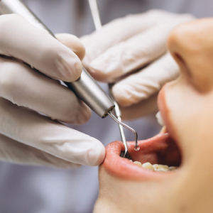 جراحة اللثة